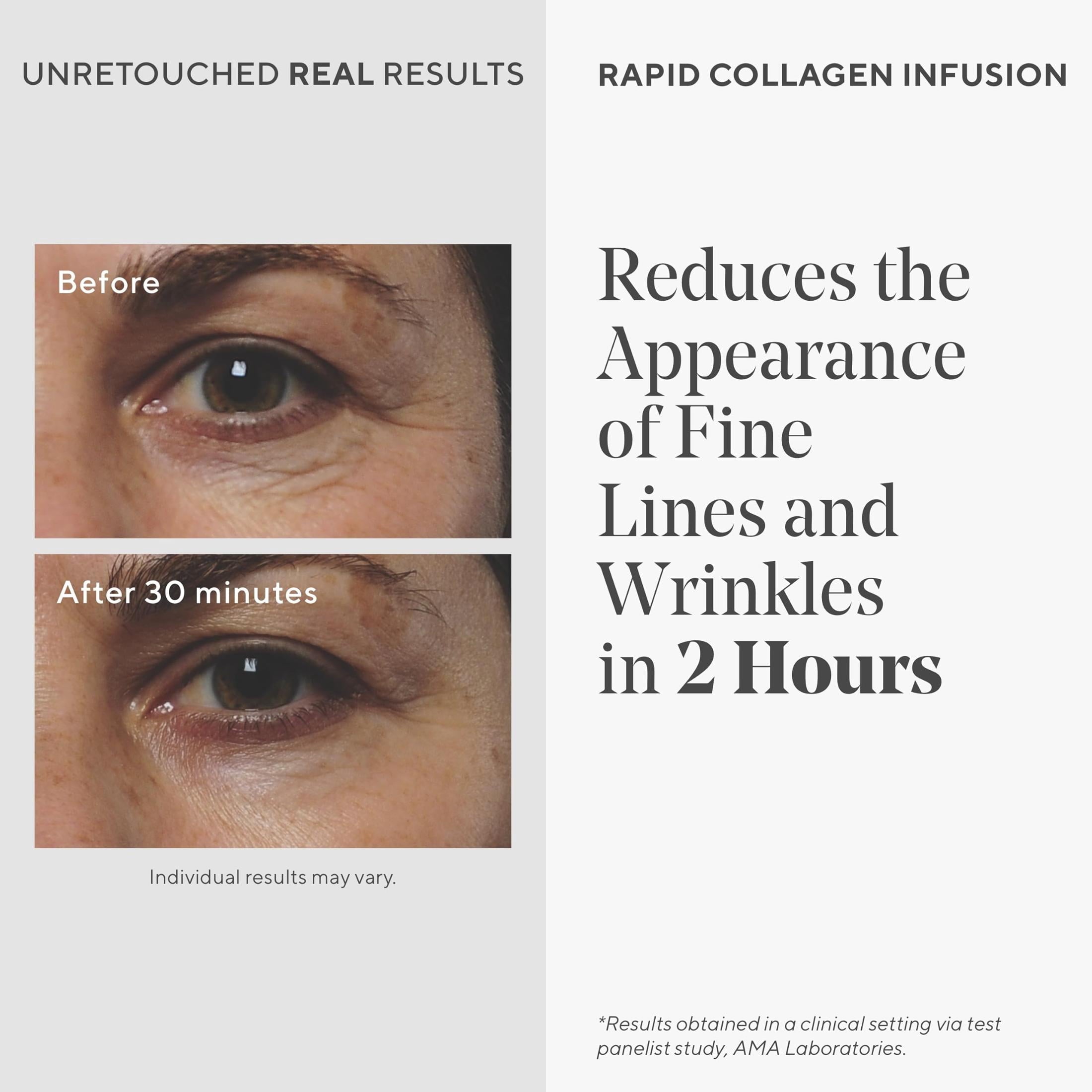 Murad Rapid Collagen Infusion, Anti-Wrinkle Serum, 1.0 fl oz image 4