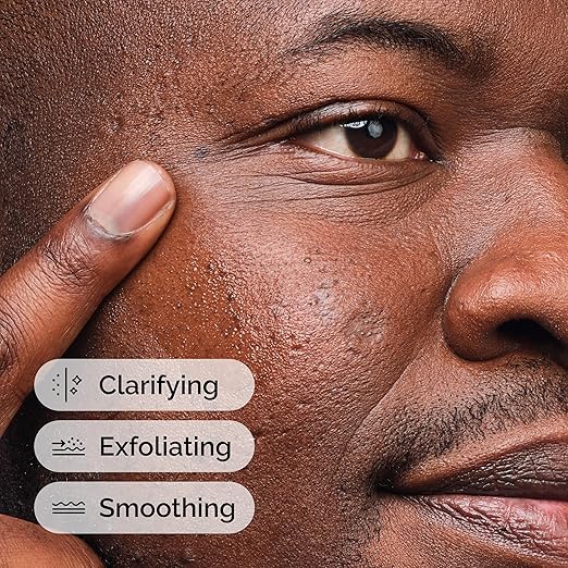 The Ordinary Salicylic Acid 2% Solution, Acne-Fighting Serum for Blemish-Prone Skin image 3