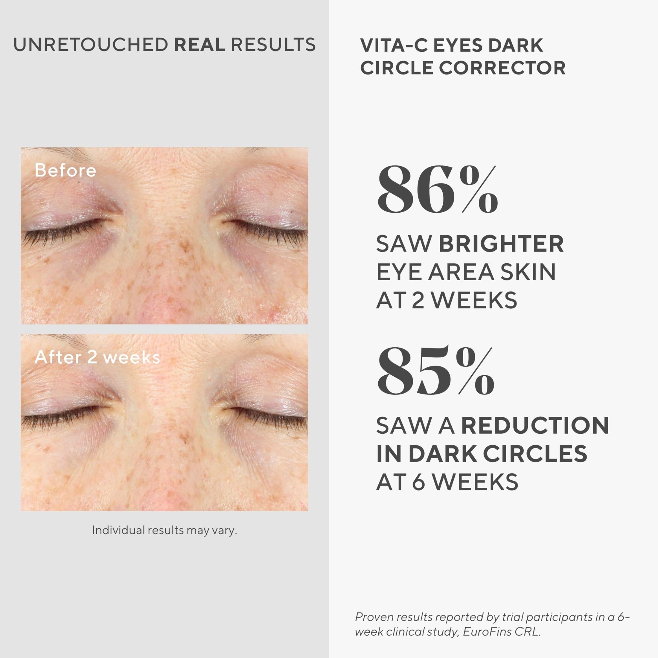Murad Vita-C Eyes Dark Circle Corrector 0.5 fl oz image 2