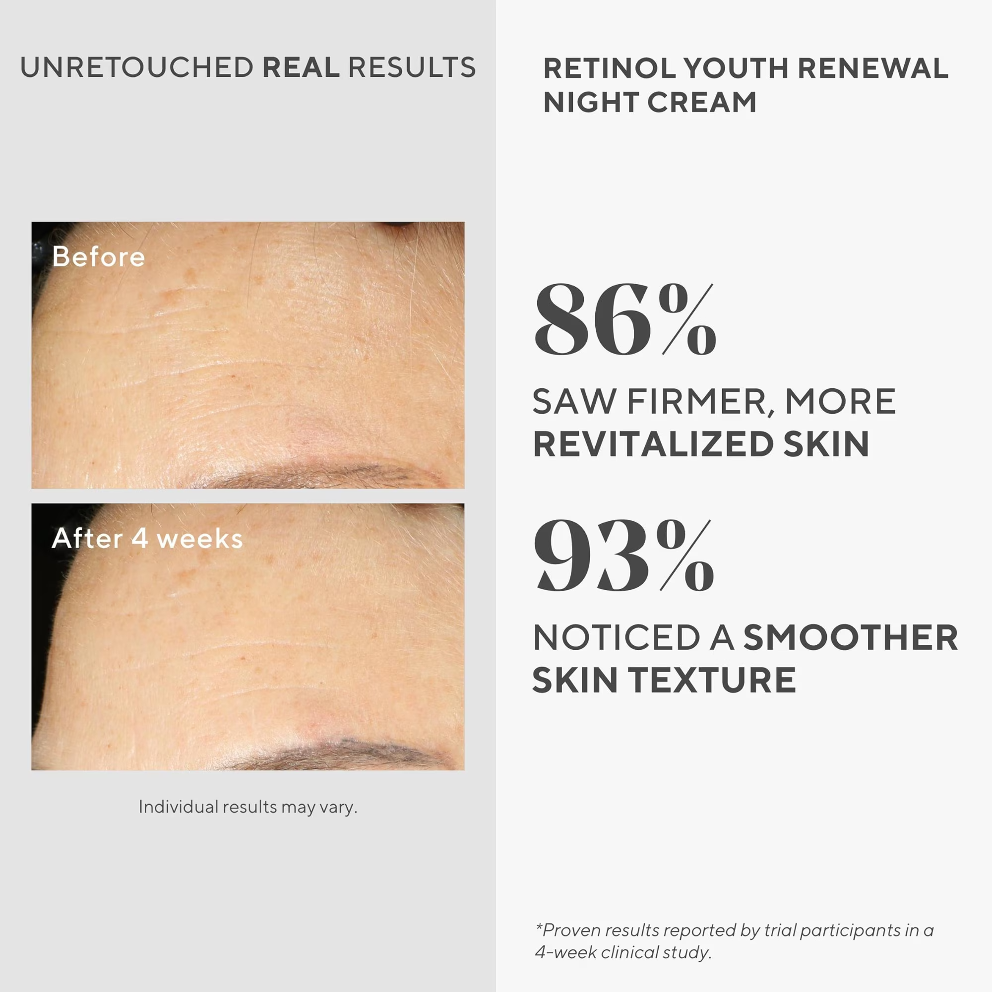 Murad Retinol Youth Renewal Night Cream, Skin Hydration, 1.7 fl oz image 6