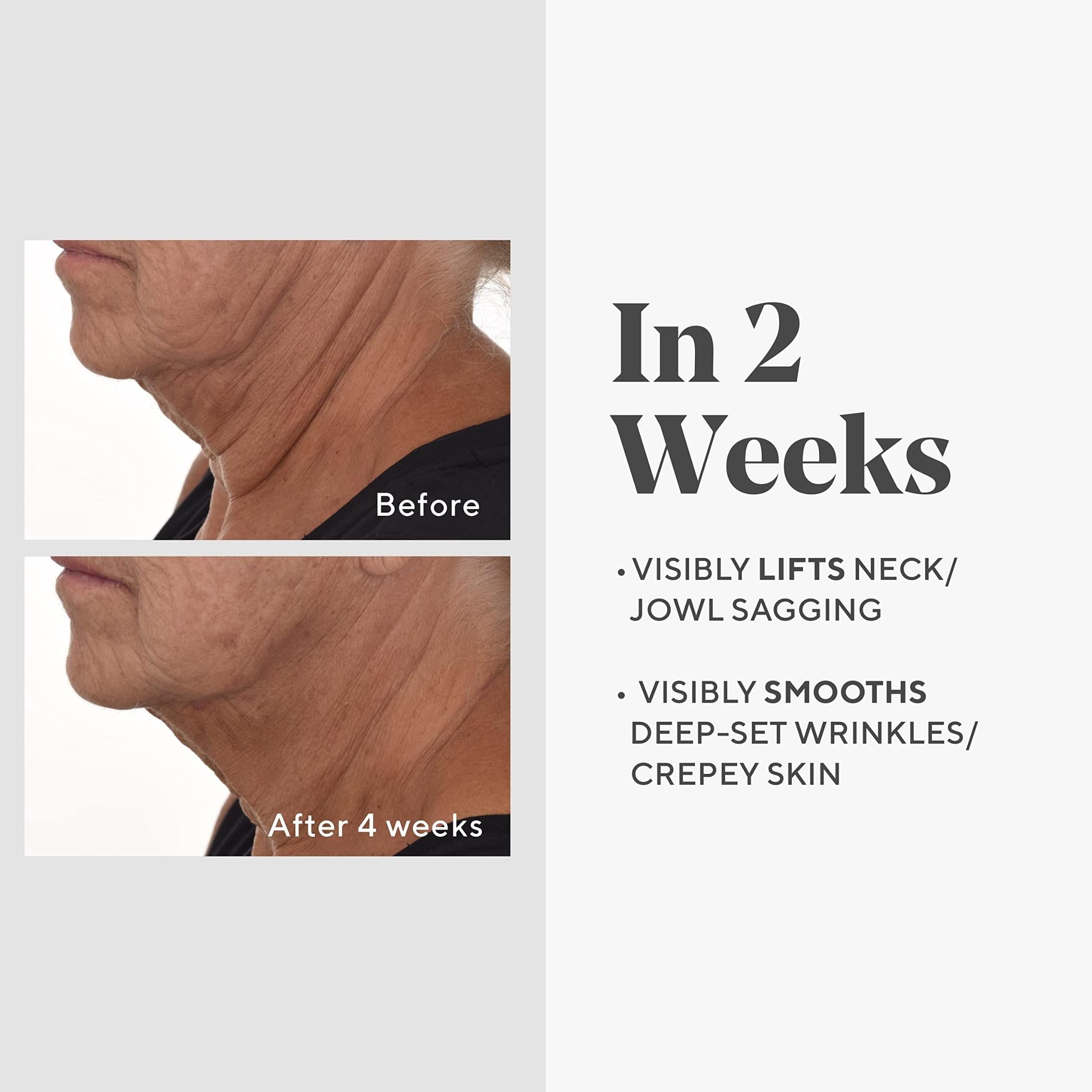 Murad Retinal ReSculpt Overnight Treatment Refill - Face & Neck Serum, Smooths Wrinkles, Lifts Sagging Skin - 1 fl oz image 3