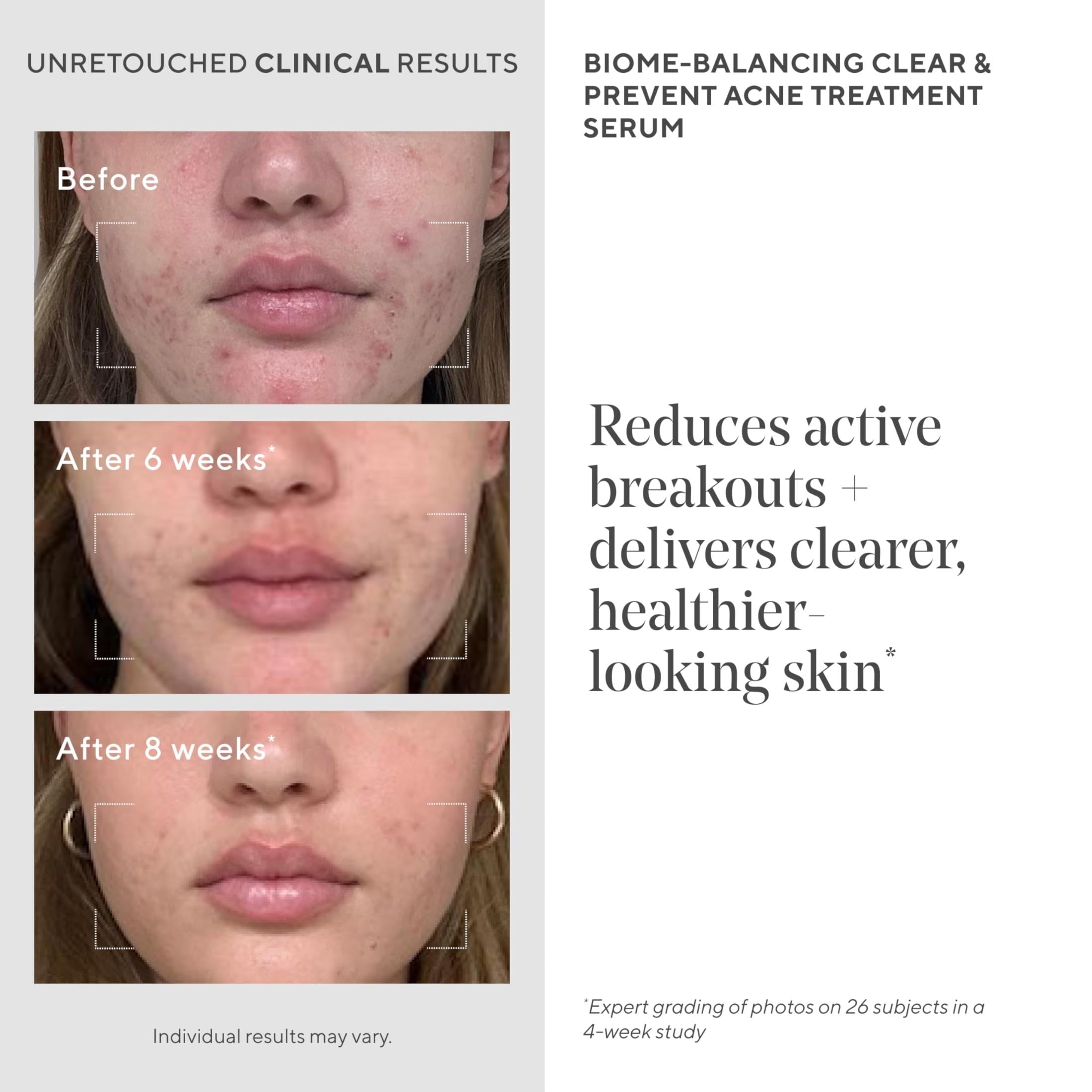 Murad Biome-Balancing Acne Treatment, Non-Comedogenic Serum, 1.0 fl oz image 3