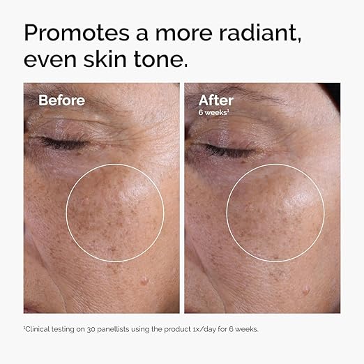 The Ordinary Glycolic Acid 7% Exfoliating Toner, Brightening and Smoothing Daily Toner for More Even-Looking Skin Tone image 4