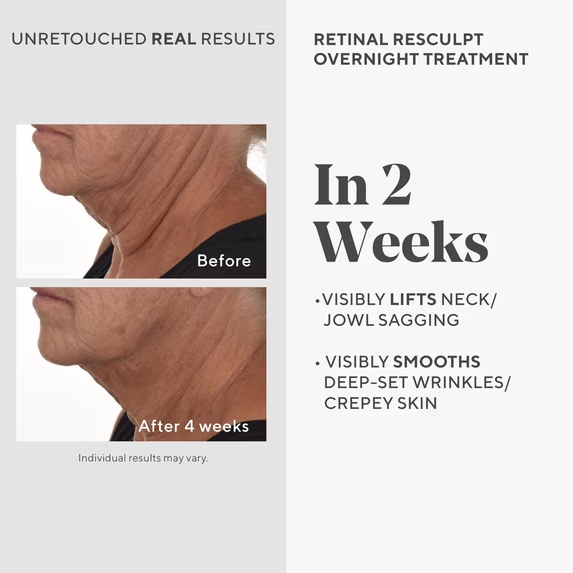 Murad Retinol ReSculpt Overnight Treatment, Smoothing Serum, 1 fl oz image 2