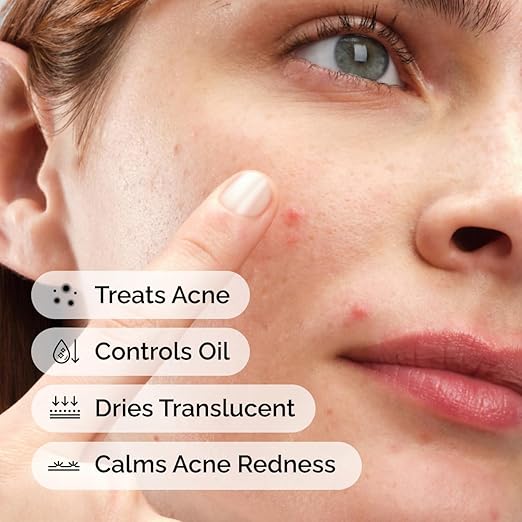 The Ordinary Sulfur 10% Powder-to-Cream Acne Spot Treatment Concentrate, Reduces Pimple Size and Zit Redness, 0.18 Oz image 5